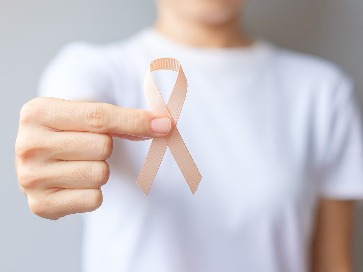 xerostomia boca seca